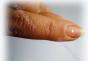 Causes des taches blanches sur les ongles